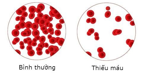 Các Tài Nguyên và Hỗ Trợ Bệnh Nhân