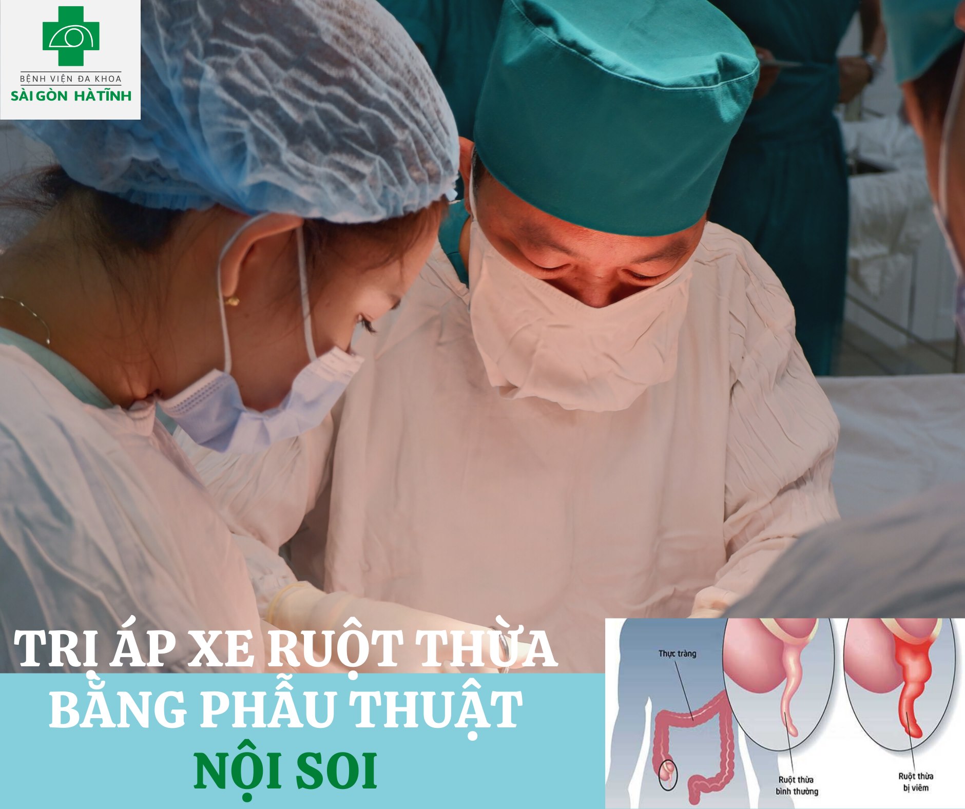 Phẫu thuật nội soi trị Áp xe ruột thừa 