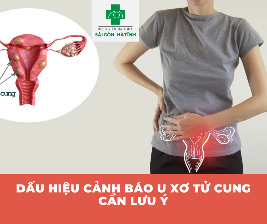 Điểm mặt những dấu hiệu u xơ tử cung sớm