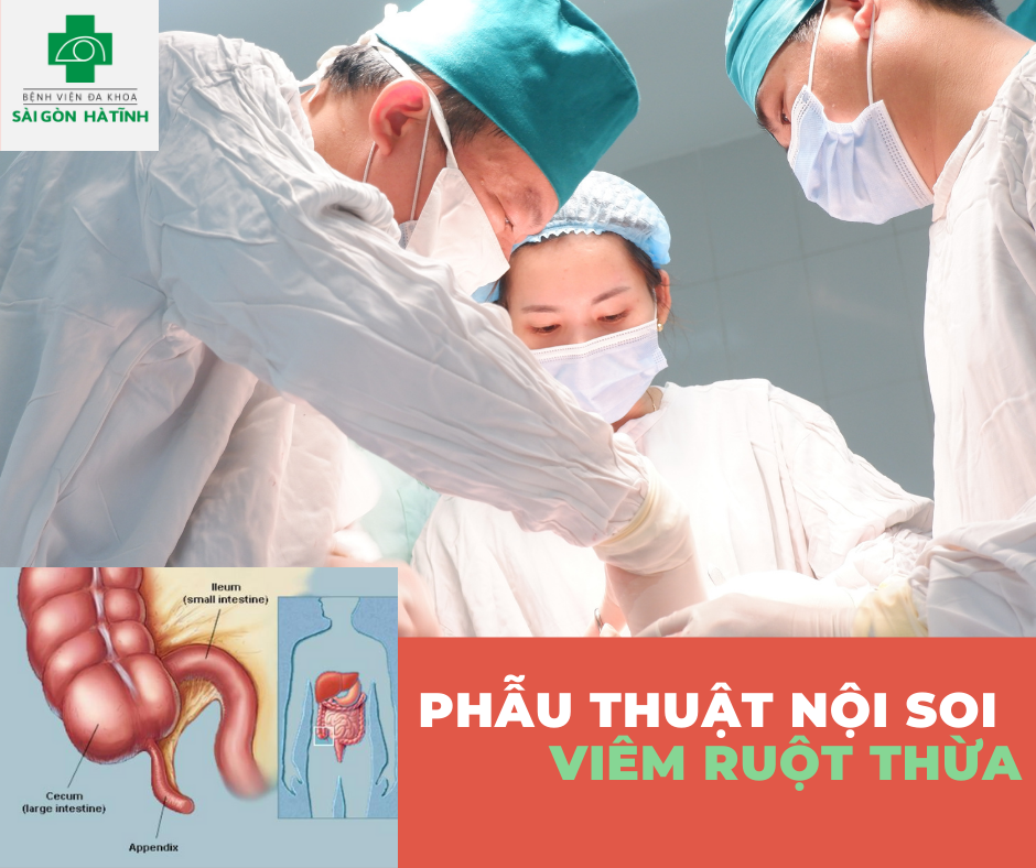 Viêm ruột thừa có dấu hiệu như thế nào?